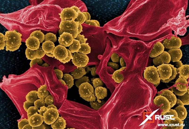 Рак переносится микробами, заявили канадцы