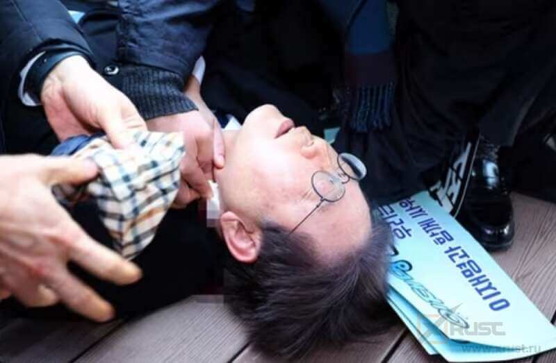 Лидер южнокорейской оппозиции получил нож в шею